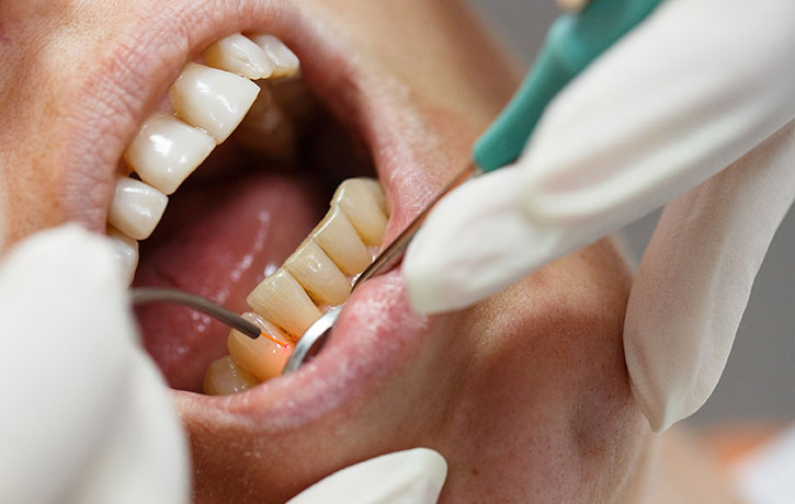 LANAP in the News Clermont, FL