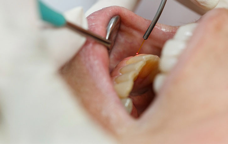 LANAP in the News Clermont, FL